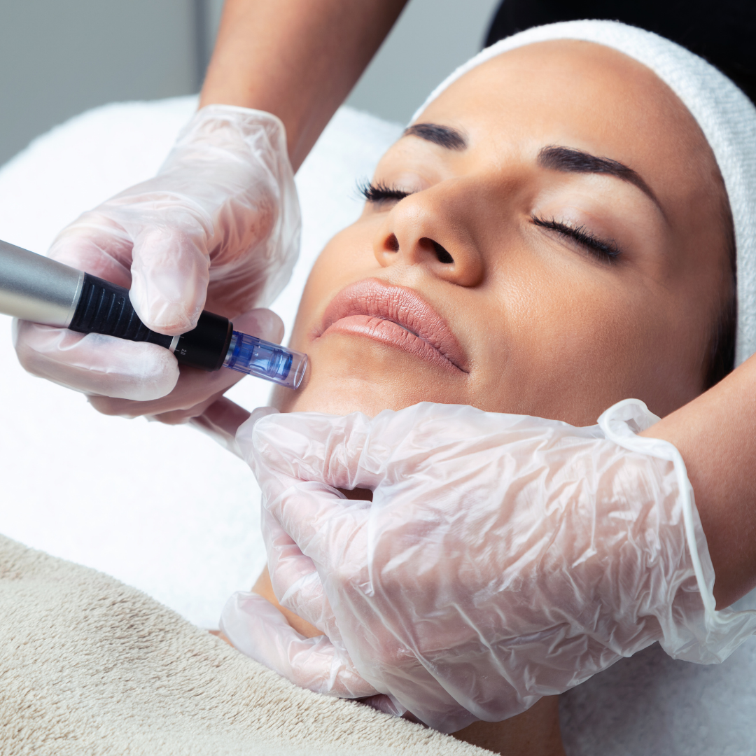 Microneedling dermatologists.pk