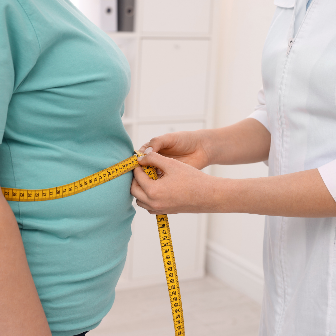 Obesity dermatologists.pk
