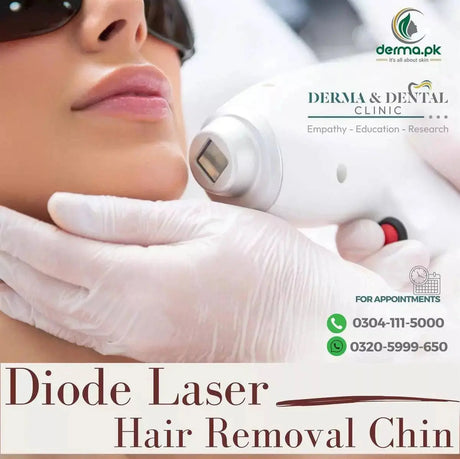 Diode Laser Hair Removal treatment