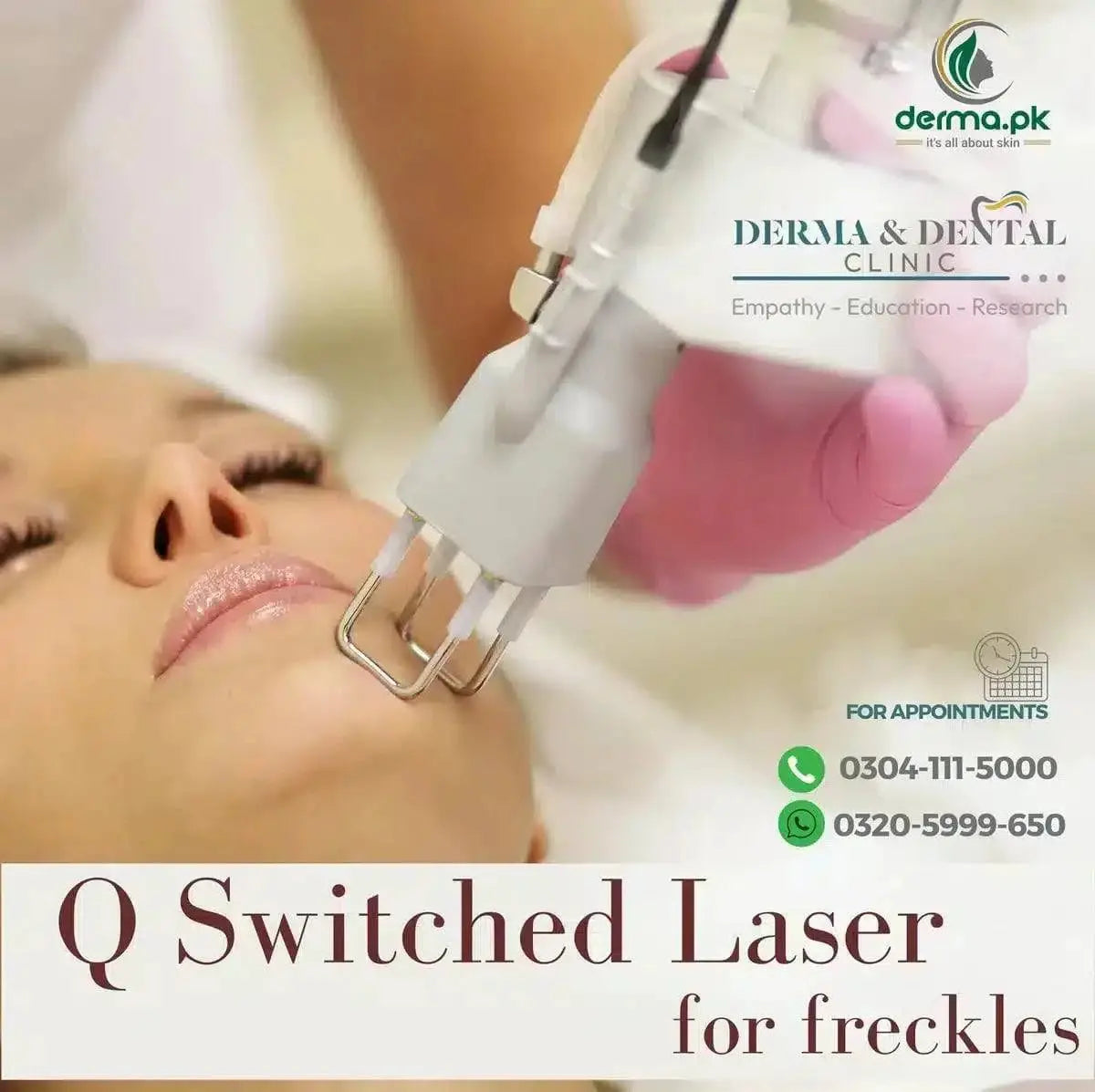 QSwitched Laser Treatment for Freckles
