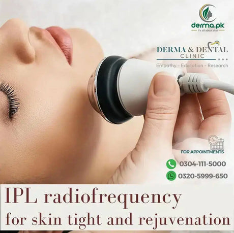 IPL Radiofrequency