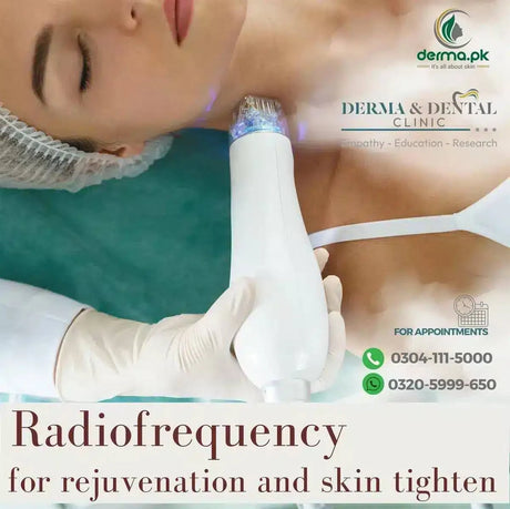 Revitalize Your Radiance: Experience Radiofrequency Skin Tightening & Rejuvenation at Derma & Dental Clinic - dermatologists.pk