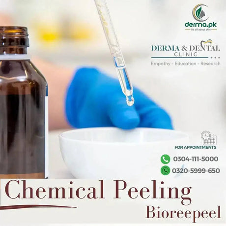 Revitalize Your Skin with Chemical Peeling Bioreepeel: Expert Dermatology at Derma & Dental Clinic - dermatologists.pk