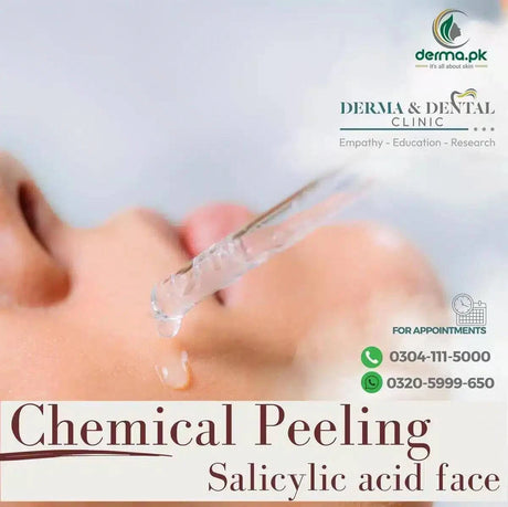 Revitalize Your Skin with Salicylic Acid Face Peeling at Derma & Dental Clinic, Bahria Town Lahore - dermatologists.pk