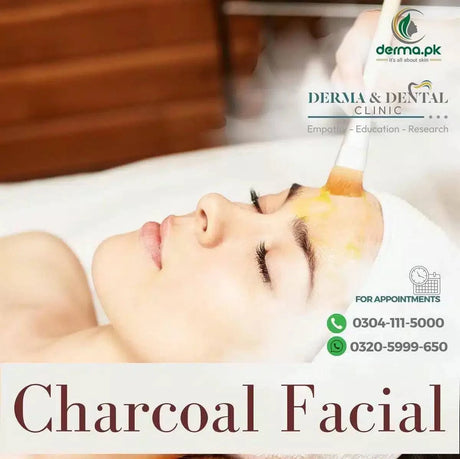 Scientific Charcoal Facial: Expert Skin Detox at Derma & Dental Clinic - dermatologists.pk