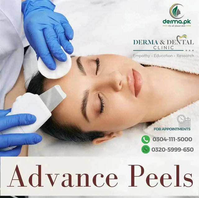 Scientific Skin Renewal: Unveiling Advanced Peels at Derma & Dental Clinic - dermatologists.pk