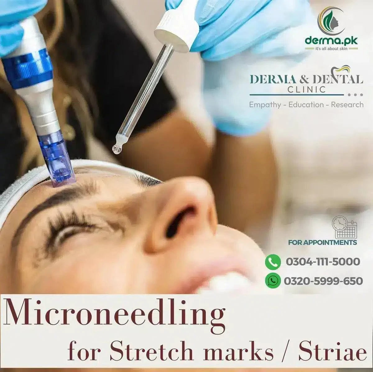 Microneedling for Stretch Marks at Derma & Dental Clinic - dermatologists.pk