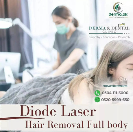 diode laser hair removal