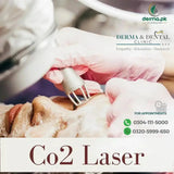 Co2 laser skin treatment 