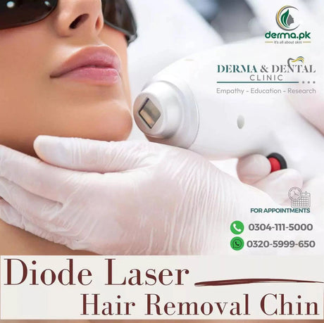  Diode Laser Hair Removal treatment 