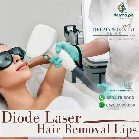 Flawless Lips Diode Laser 
