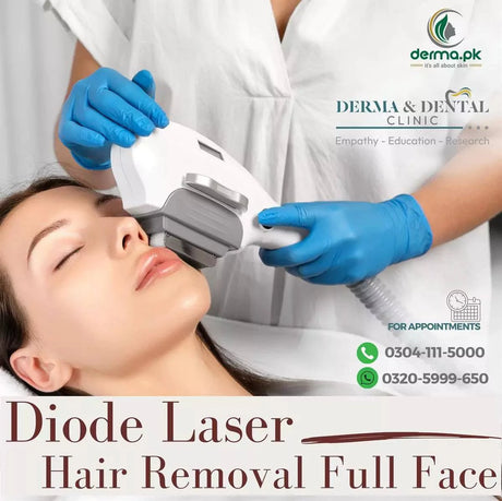hair removal laser treatment