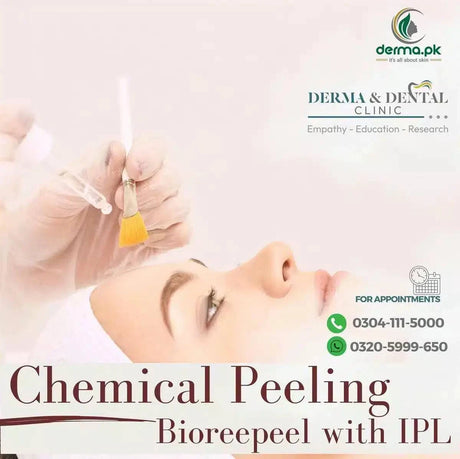 IPL hair removal treatment 