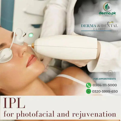  IPL Photofacial and Rejuvenation