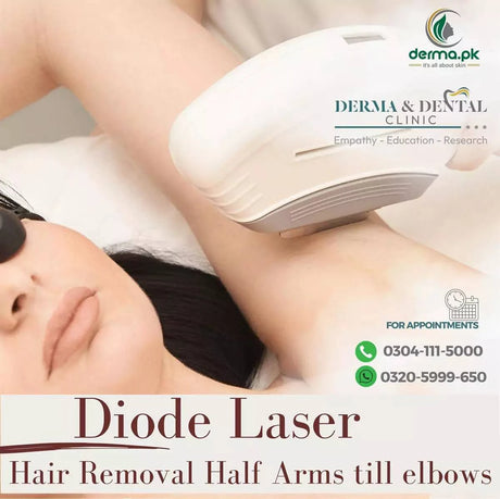 laser hair removal half arm