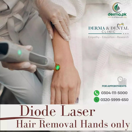 Precision Diode Laser Hair Removal for Hands: A Scientific Approach at Derma & Dental Clinic - dermatologists.pk