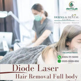 hair removal laser for dark skin