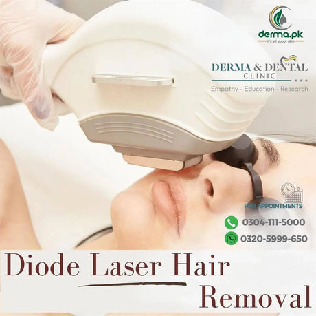 Scientific Diode Laser Hair Removal