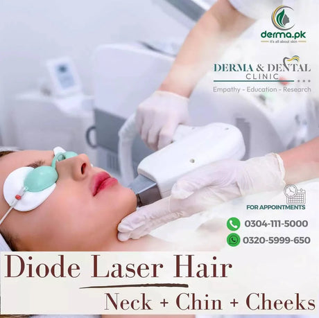 Diode Laser Hair Removal