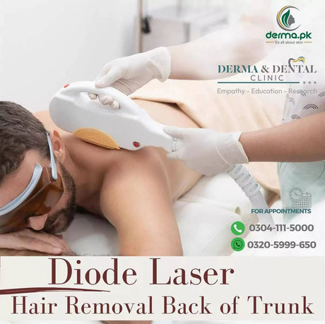 The Science of Diode Laser Hair Removal for Back of Trunk at Derma & Dental Clinic - dermatologists.pk